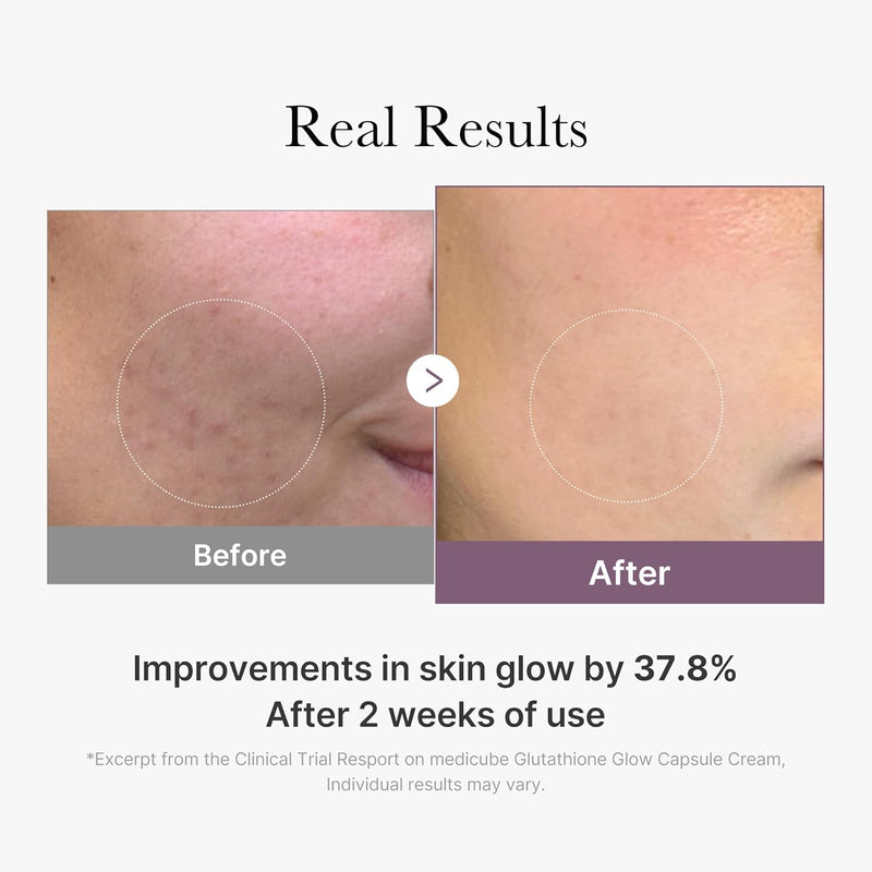 Medicube AGE-R Glutathione Glow Capsule Facial Cream - Instant Lifting Moisturizer - Collagen Peptide For Hydrating Glow - Improve Blemishes, Uneven Skin Tone