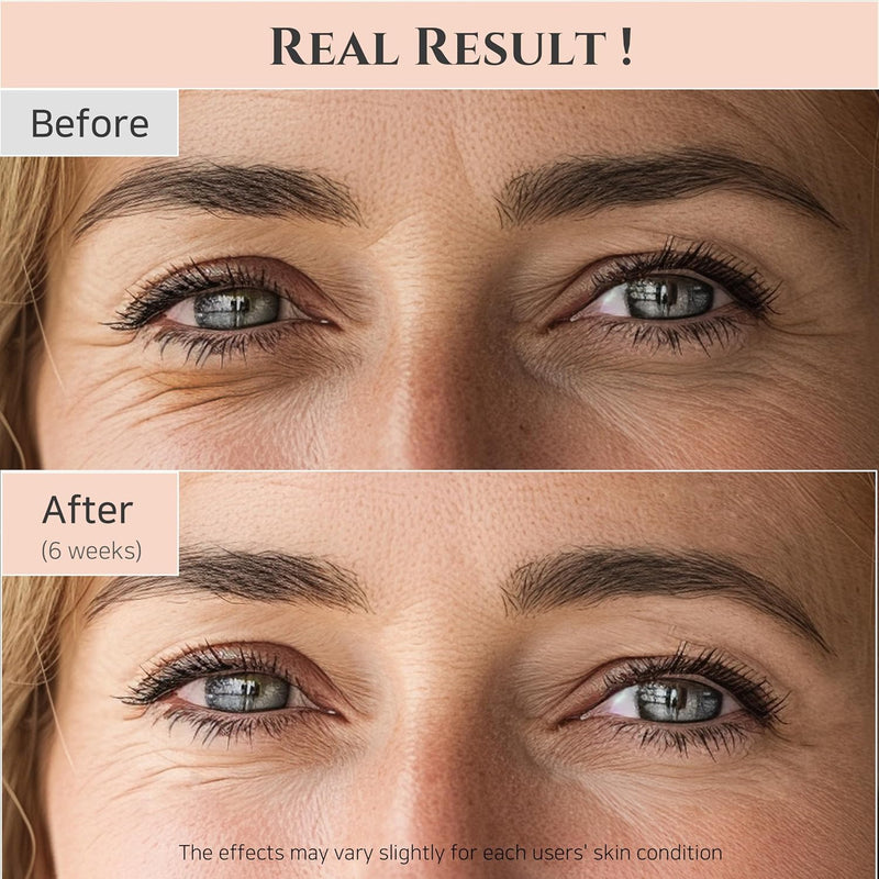 Beauty of Joseon Revive Eye Serum with Retinal Niacinamide Correction for Puffy Eye Bags Fine Lines Dark Circles Wrinkles, Korean Skin Care