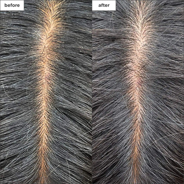 BRIOGEO Scalp Revival Charcoal + Tea Tree Cooling Hydration Mask for Dry and Itchy Scalp