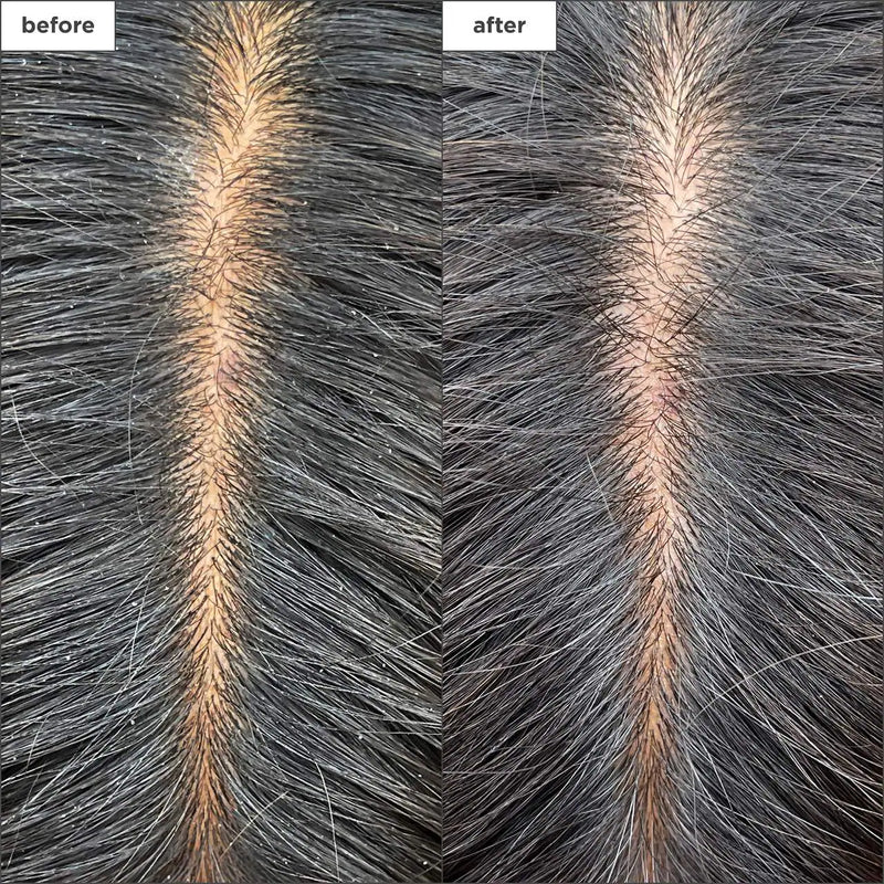 BRIOGEO Scalp Revival Charcoal + Tea Tree Cooling Hydration Mask for Dry and Itchy Scalp